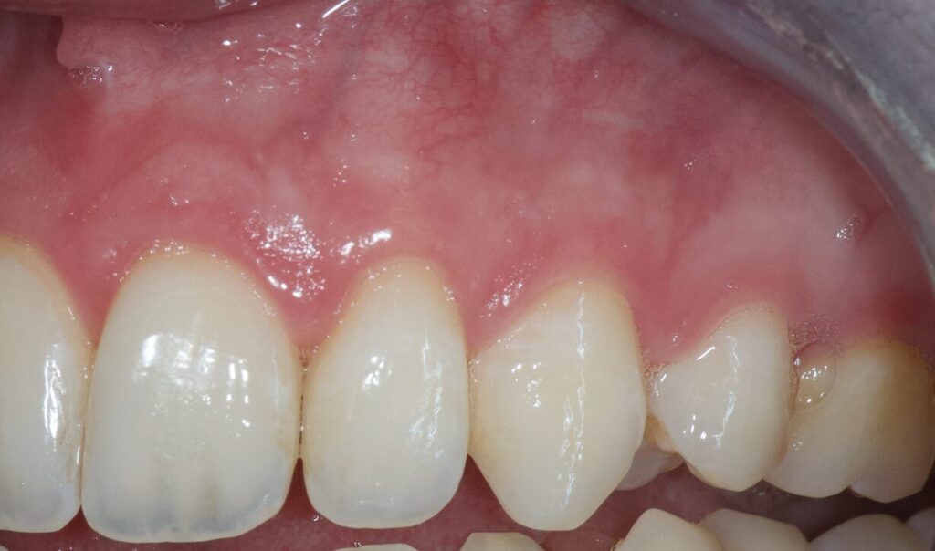 soins-lallam-lefloch-laroye-barbant